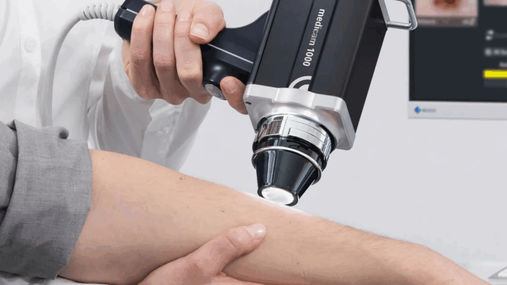 Aparelho usado para mapeamento de câncer de pele